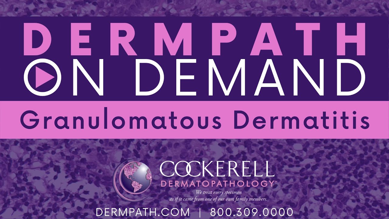 Granulomatous Dermatitis 