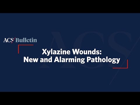 Xylazine Wounds: New and Alarming Pathology - video from JOMI