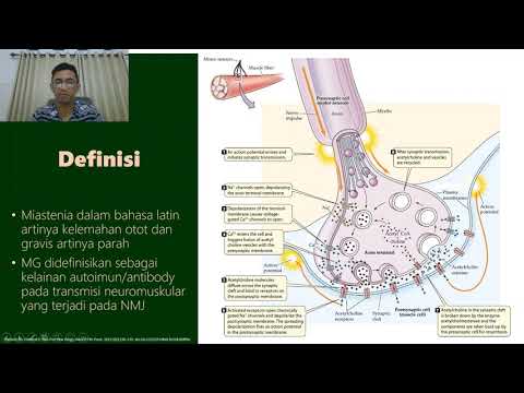 Video: Kelemahan Terkait Statin Pada Myasthenia Gravis: Laporan Kasus