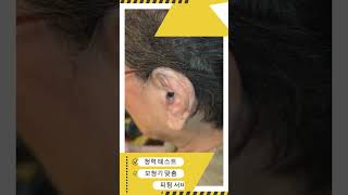 초소형 포낙 보청기 99만원 부터 맞춤 제작