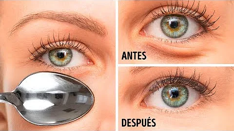 ¿El hielo reduce las bolsas de los ojos?