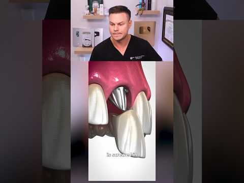 Why Your Bone