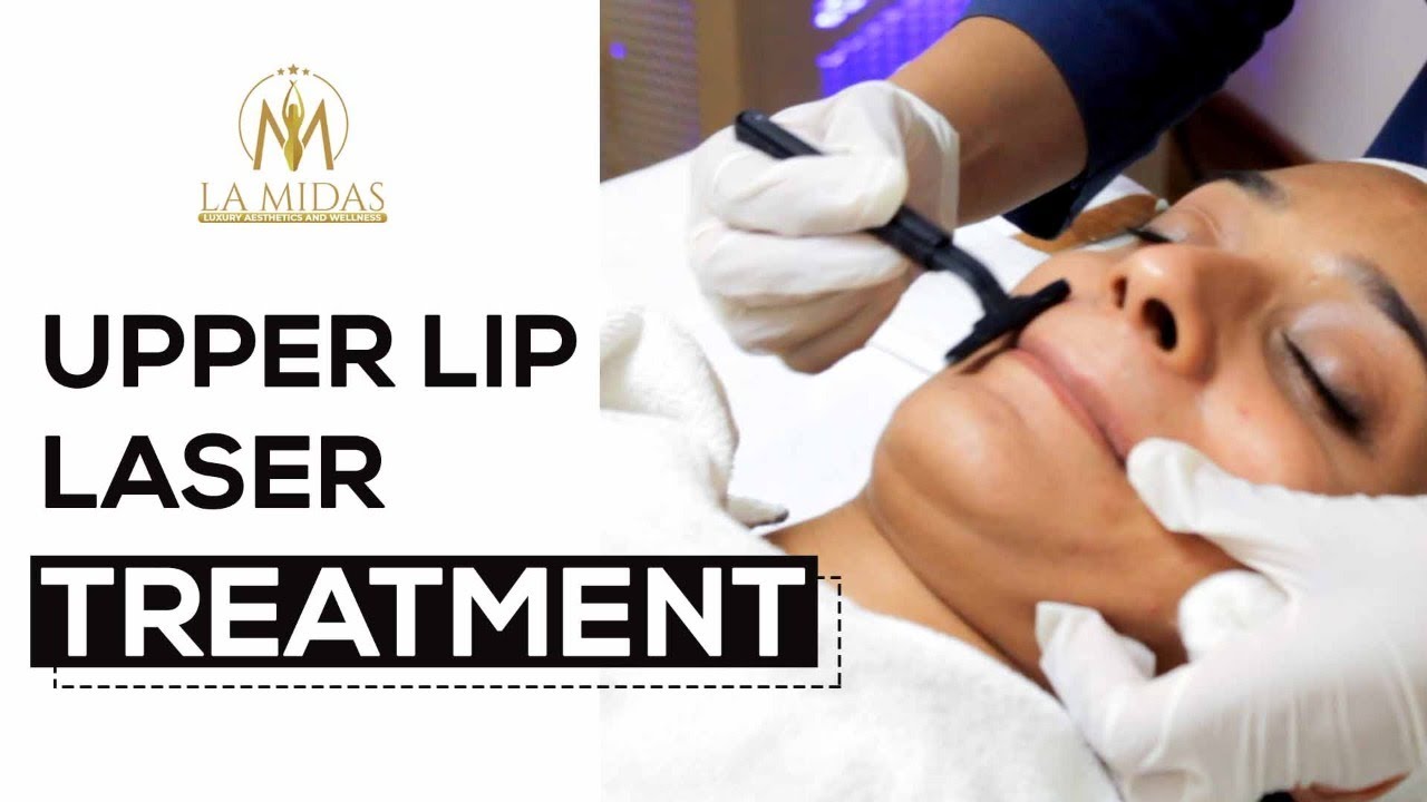 Laser Face Hair RemovalPatient Experience of Laser Face Hair Removal