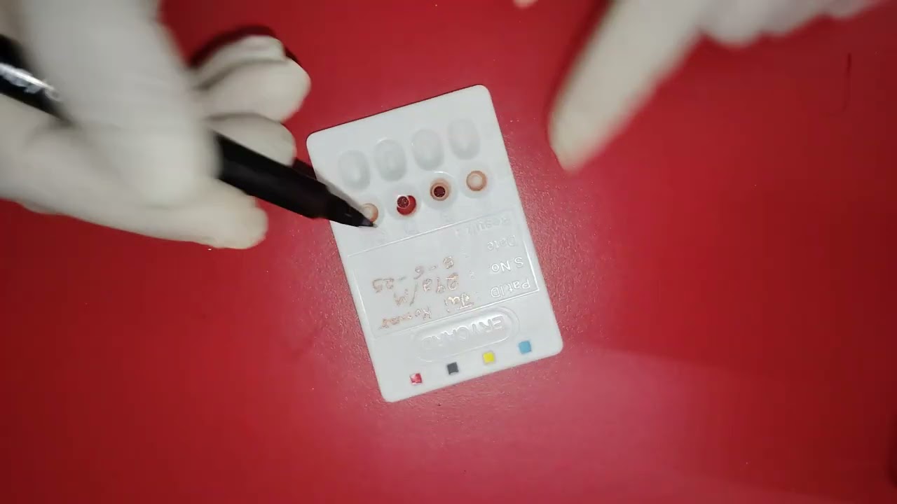 Blood Group Card method....Blood Grouping Card for ABO/Rho(D)....