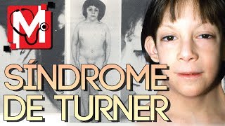 El SÍNDROME de TURNER 🙍‍♀️🤷‍♀️