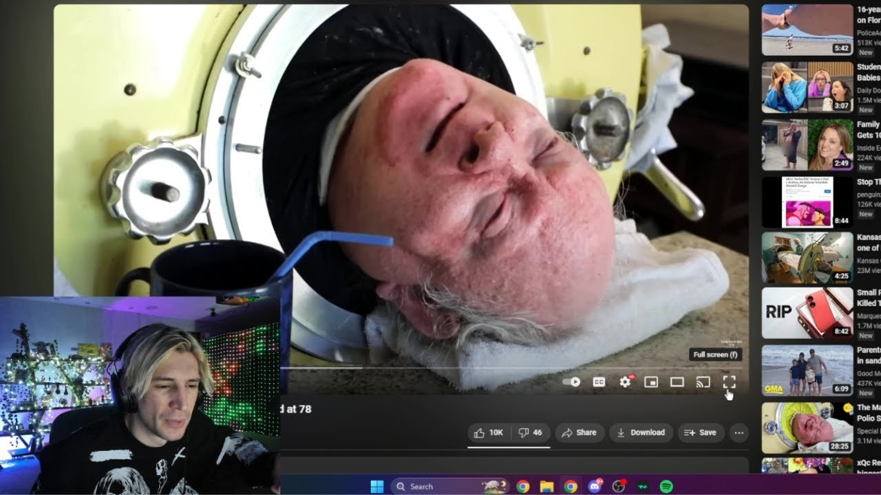 xQc reacts to Longest Living Polio Survivor in Iron Lung Dead at 78