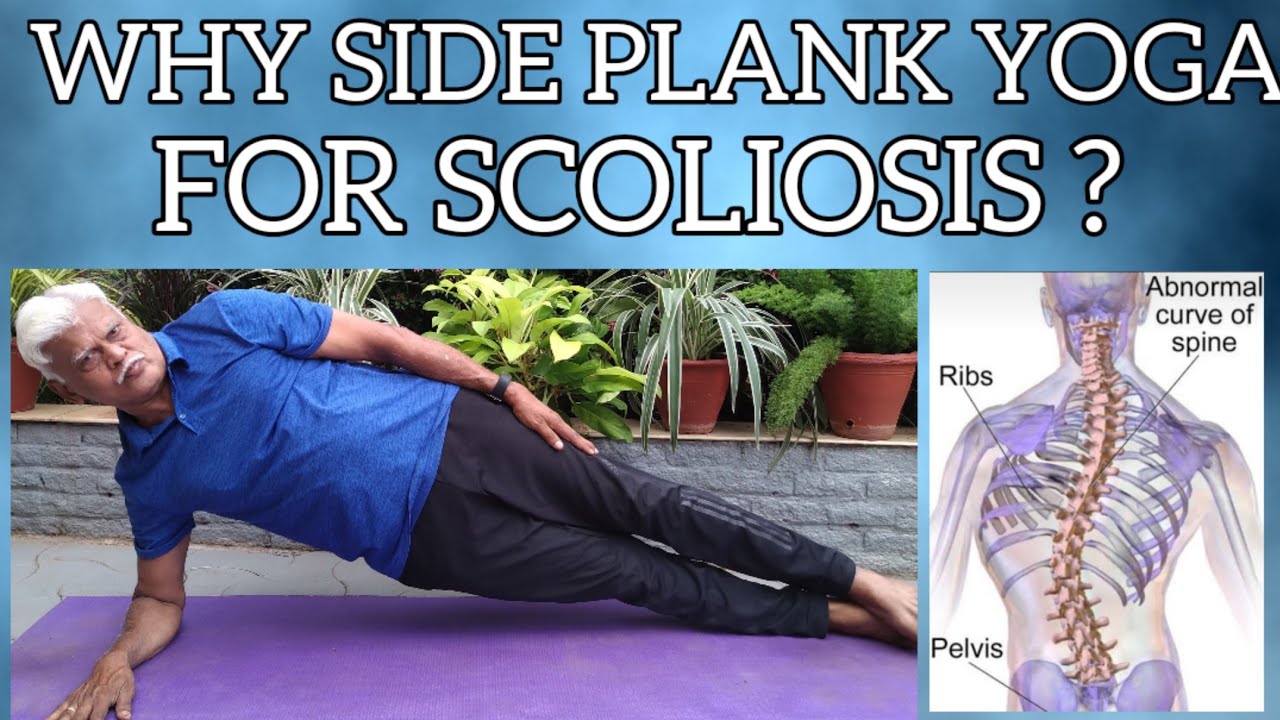 Why side plank yoga for Scoliosis?side plank yogaScoliosissteps