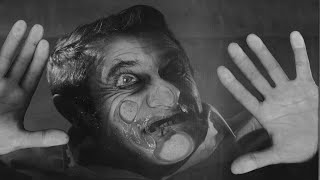 Frustration - When Does A Banknote Start To Burn Official Video