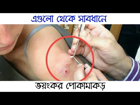 ভিডিও: বিশ্বের সবচেয়ে বিষাক্ত কীট কী কী?