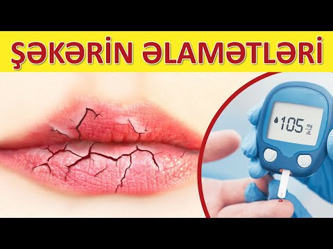 Video: Şəkərli diabetlə necə arıqlamaq olar (şəkillərlə)