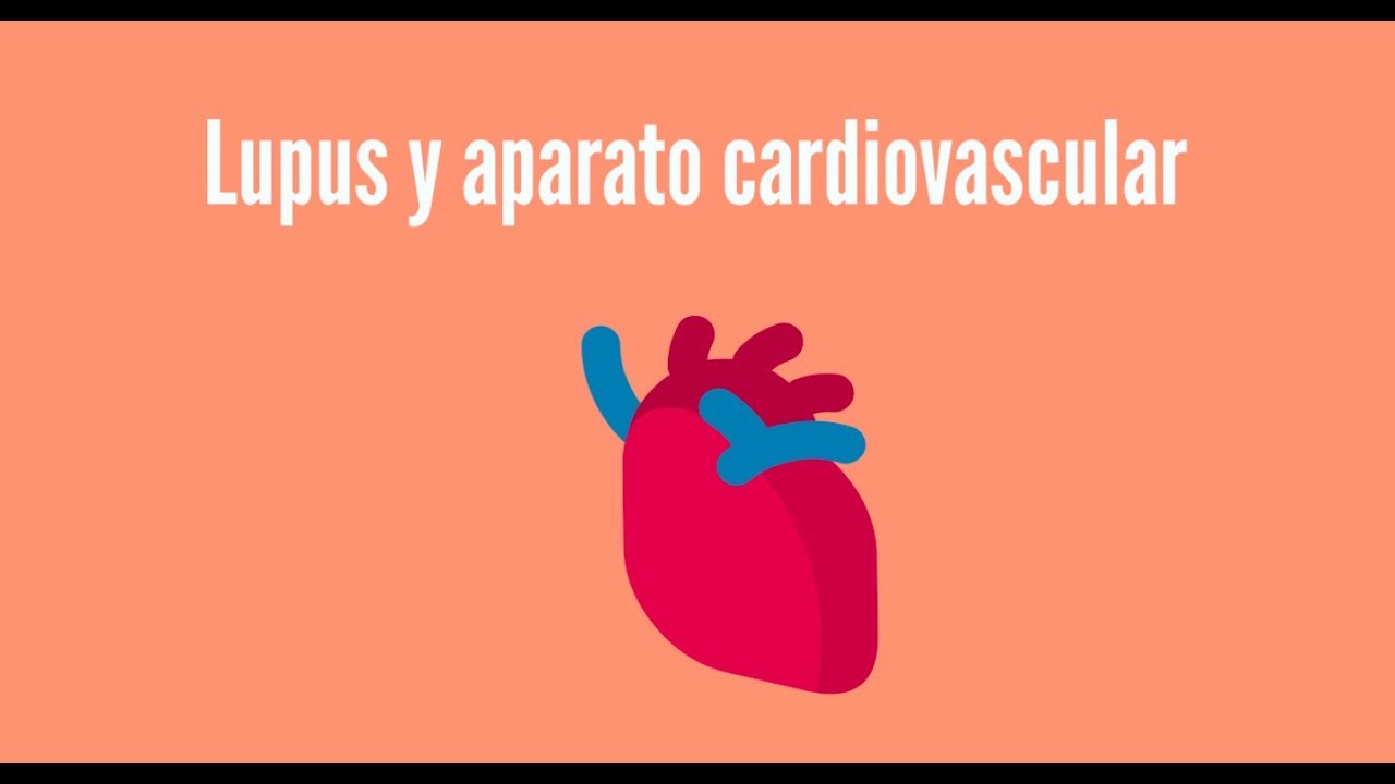 lupus y aparato cardiovascular