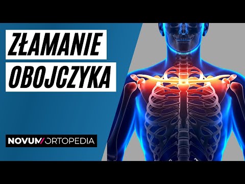 Złamanie obojczyka - sposoby leczenia i rehabilitacji | Novum Ortopedia