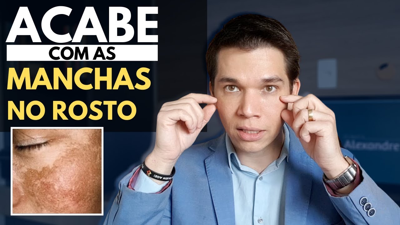 Acabe com as MANCHAS NA PELE, inclusive MELASMA - Receita Caseira