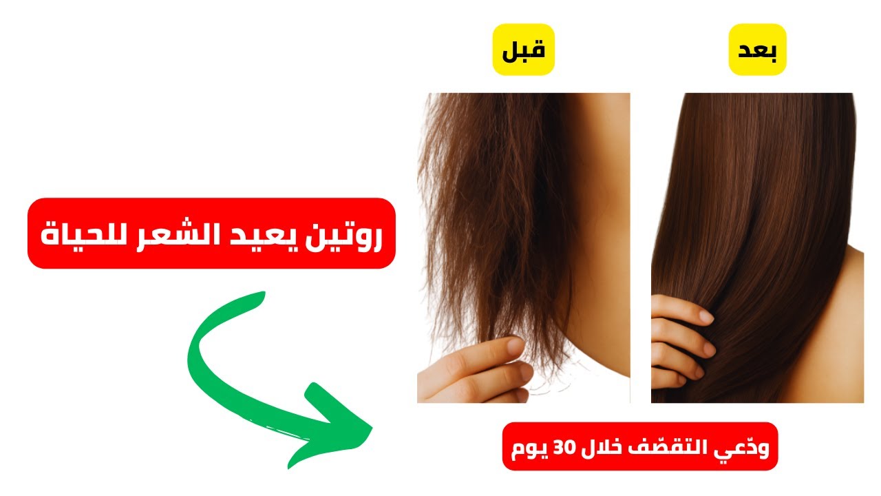 عالجي التقصّف من الجذور إلى الأطراف… في 30 يوماً فقط!