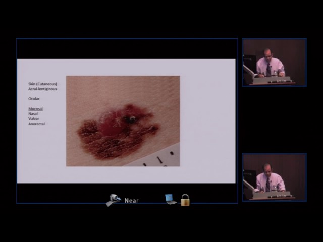 AIM at Melanoma Symposium 2016: Part I