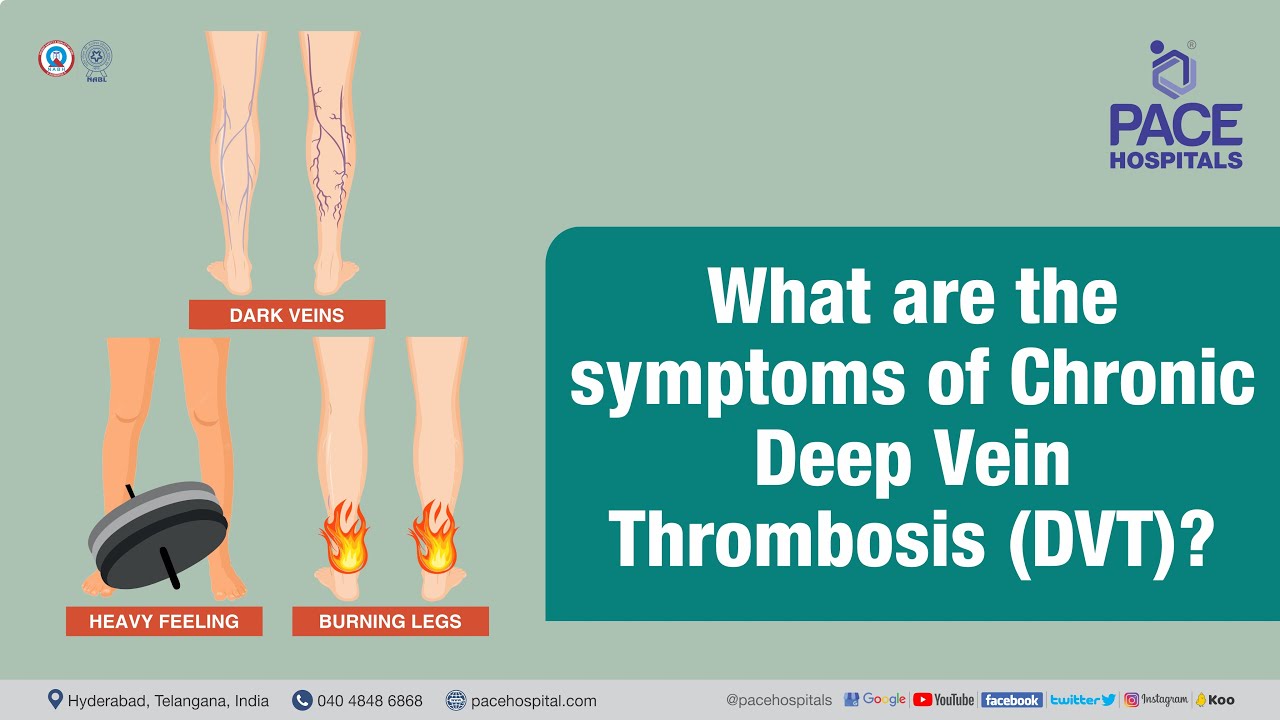 What are the Symptoms of Chronic Deep Vein Thrombosis (DVT)?