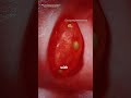 How tonsil stones are form?(3D animation) #slipdiscsurgery #science #3danimation #humananatomy