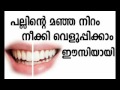 Teeth Whitening in 10 minutes.