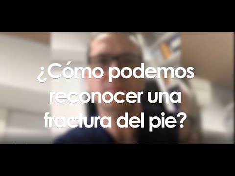 Vídeo: Dedo Del Pie Fracturado