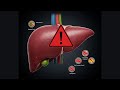 Your Liver Is Dying – Stop Eating These 6 Common Foods!