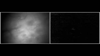In vivo imaging with Miniscope in dorsal striatum