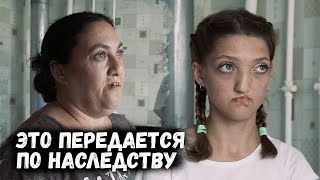 ЗАЯЧЬЯ ГУБА ПО НАСЛЕДСТВУ/ПАНДУС ДЛЯ СВЕТЛАНЫ/ОРЛОВЕЦ