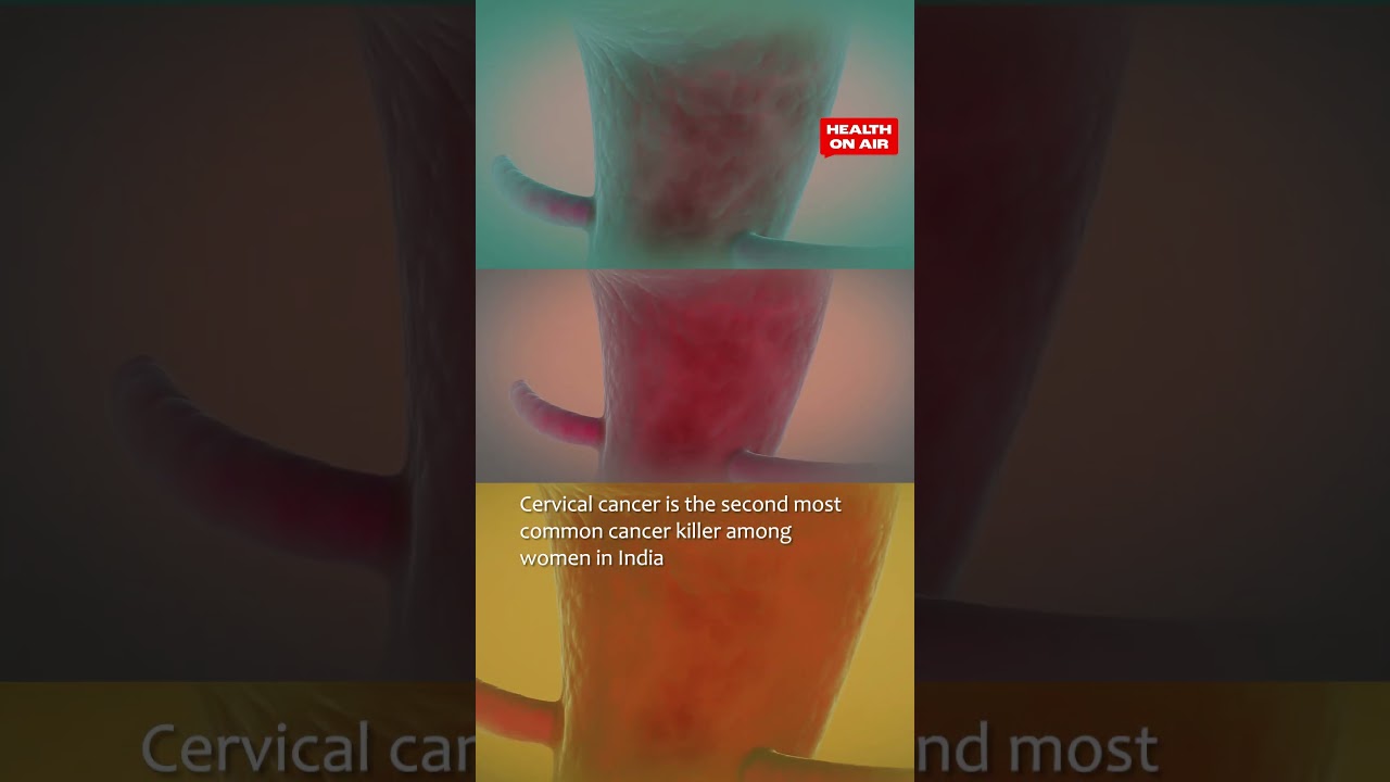 Reports of Poonam Pandey's death: A quick guide to Cervical Cancer