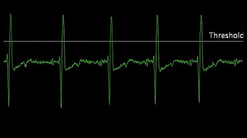 EKG SpikerShield - Action Potentials of the Heart