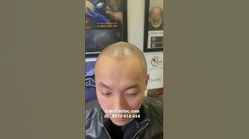 xăm tóc tại vnscalp, Hói đầu mất tự tin, mặc cảm, gặp thợ xăm không đẹp thì sống sao
