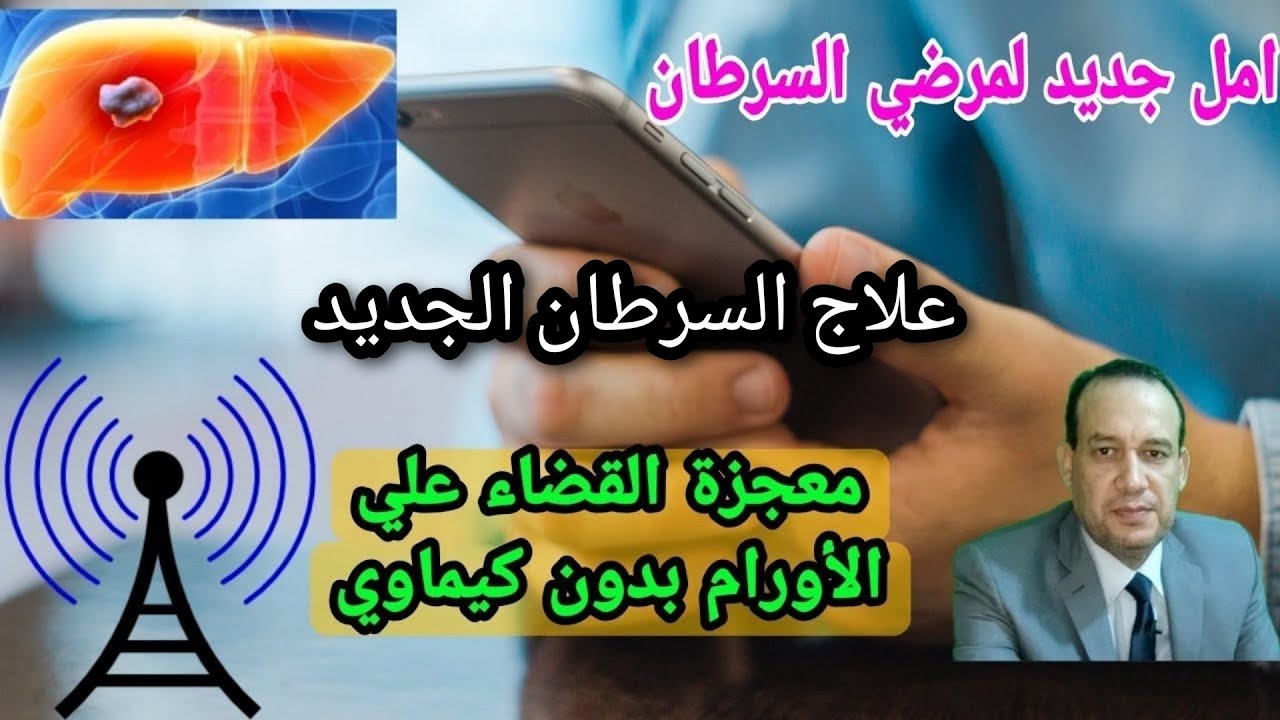 علاج السرطان الجديد / امل لمرضي السرطان/ علاج الاورام بدون كيماوي