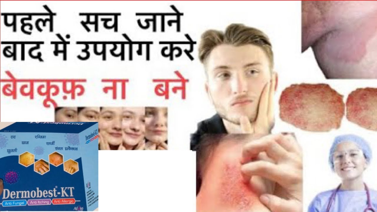 Dermabest Kt Cream dermabest-kt-cream