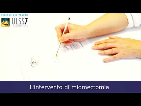 intervento-di-miomectomia