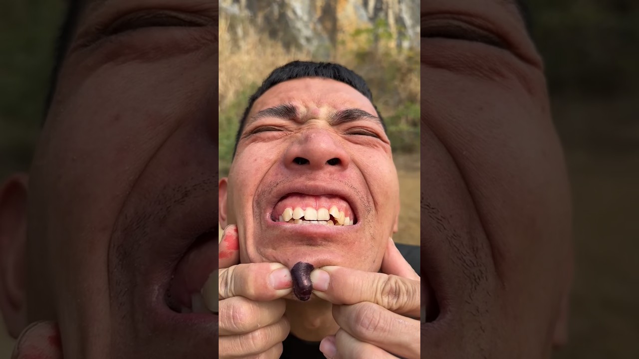 How I Cured a Bug🤣😡😂🫣 Bite with Yogurt in the Wild