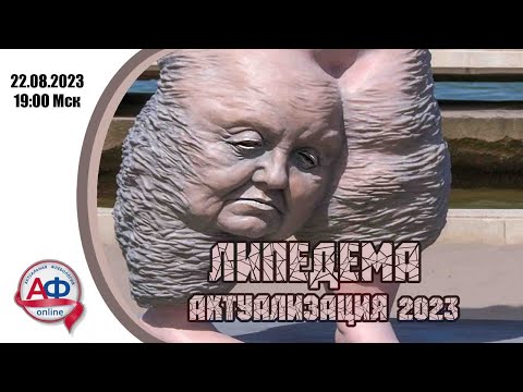 Липедема 2023