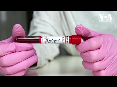 კოვიდ-19-ის უჩვეულო სიმპტომები ინფიცირებიდან თვეების შემდეგ