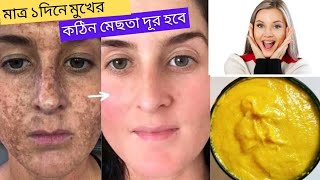 টমেটো দিয়ে মেছতা দূর করার উপায়/ঘরোয়া ভাবে ত্বক ফর্সা ও উজ্জ্বল হবে মাত্র ১ দিনে/skin care screenshot 4