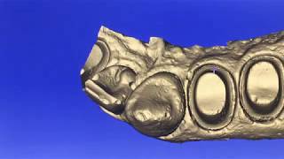 Cerec Connect with STL export