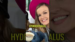 What Really Happened To Terra Jolé From Little Women?