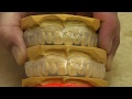 How to make a custom mouthguard