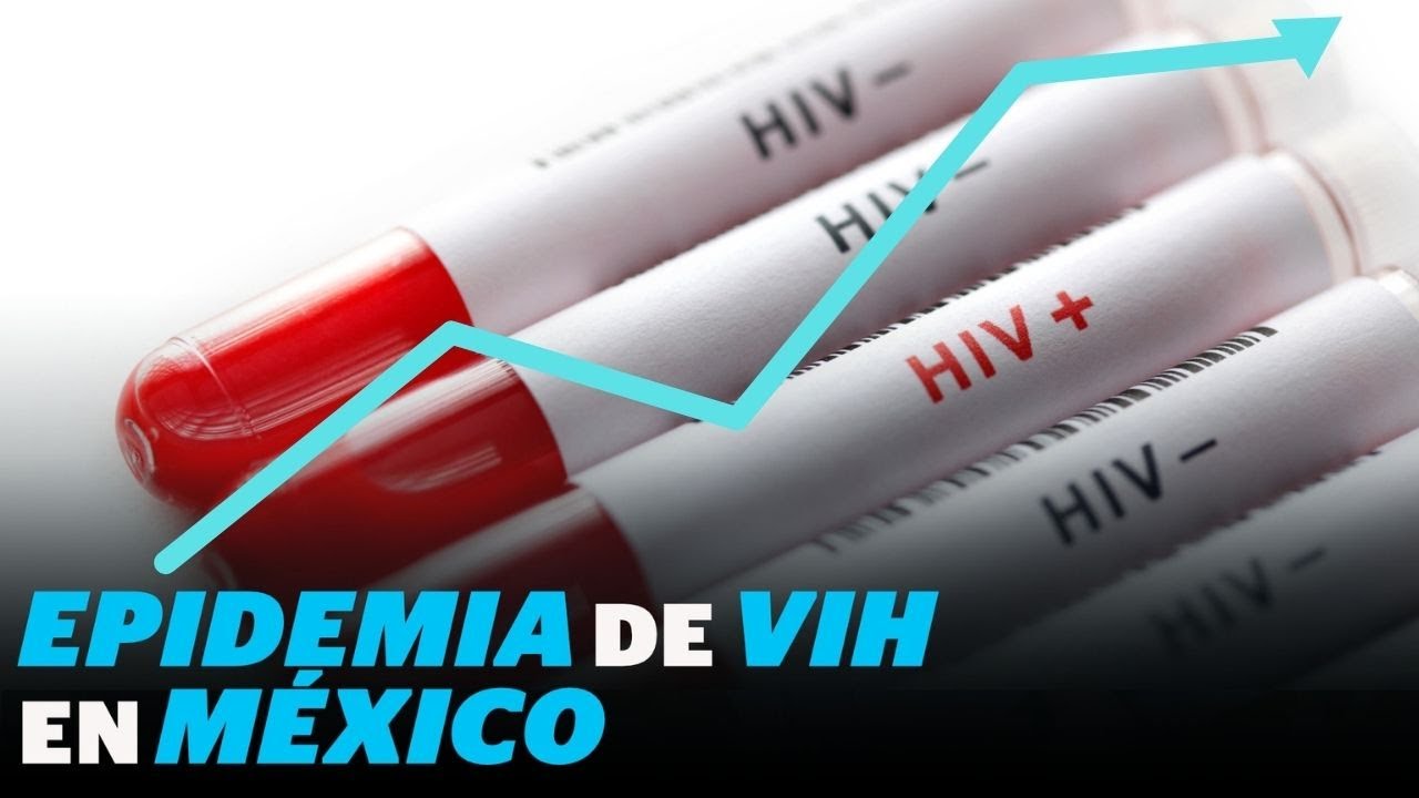 El VIH, la epidemia en México: de 15 mil a 360 mil casos en menos de ...