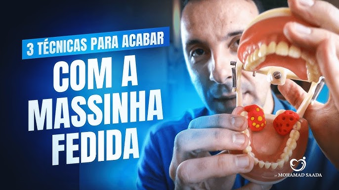 Cáseos: saiba como prevenir as desagradáveis 'pedrinhas' que se