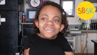 Adopted By Parents With The Same Diagnosis Brittle Bone Disease