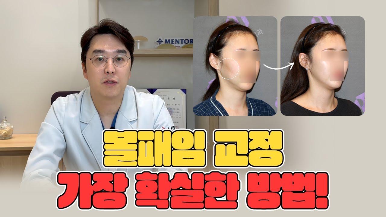 광대수술 부작용? NO! 100% 볼패임/볼꺼짐 교정 방법