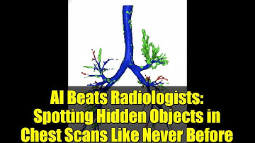 AI Beats Radiologists: Spotting Hidden Objects in Chest Scans Like Never Before