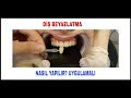 DİŞ BEYAZLATMA|ZARARLI MI #dişbeyazlatma