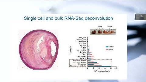 Multi-omics view on human atherosclerosis - Cardiology Rounds with Lars Maegdefessel