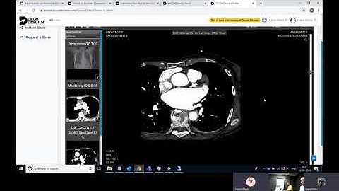 Building 3D VR Models with Dicom Director