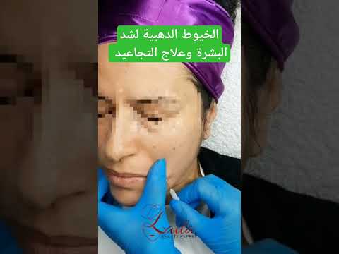 الخيوط الدهبية لشد البشرة وعلاج التجاعيد  تجاعيد الوجه شد البشرة الخيوط الدهبية