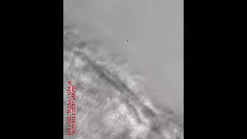 Lateral View of Normal Cilia