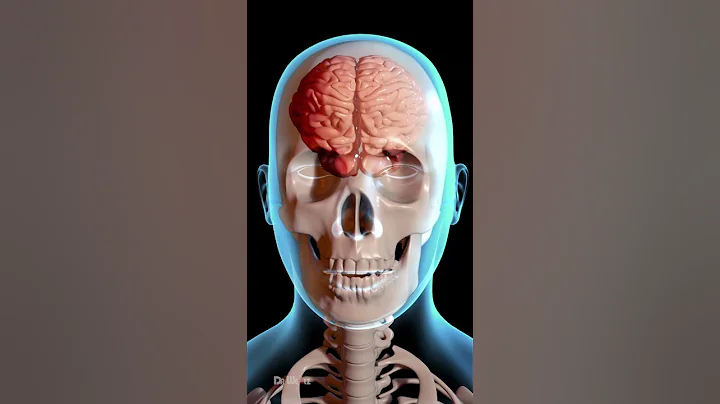 How Does a Concussion Affect Your Brain